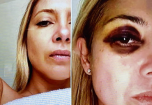 Tras la denuncia a Alberto Fernández, se conocieron las fotos de Fabiola Yañez golpeada